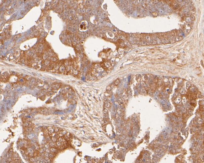 GADD34 Antibody in Immunohistochemistry (Paraffin) (IHC (P))