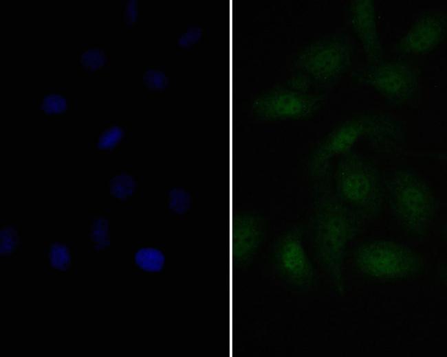 PAX8 Antibody in Immunocytochemistry (ICC/IF)