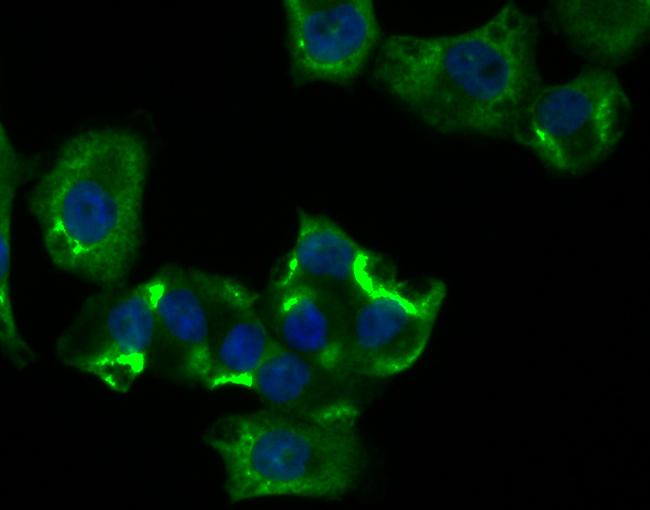 RIP3 Antibody in Immunocytochemistry (ICC/IF)