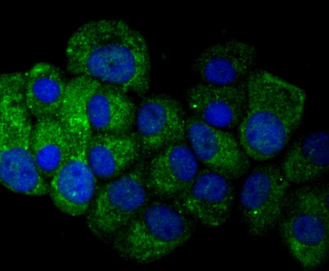 Osteopontin Antibody in Immunocytochemistry (ICC/IF)