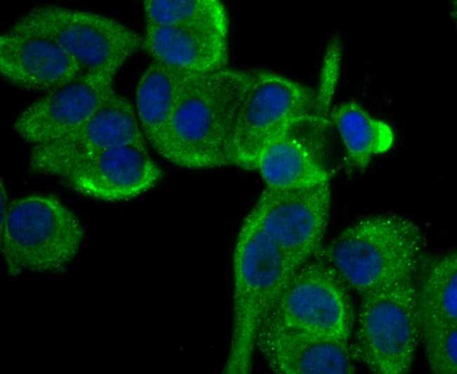 Cytokeratin 8 Antibody in Immunocytochemistry (ICC/IF)