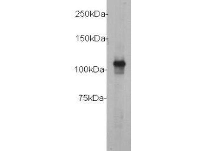 c-Myc Antibody in Western Blot (WB)