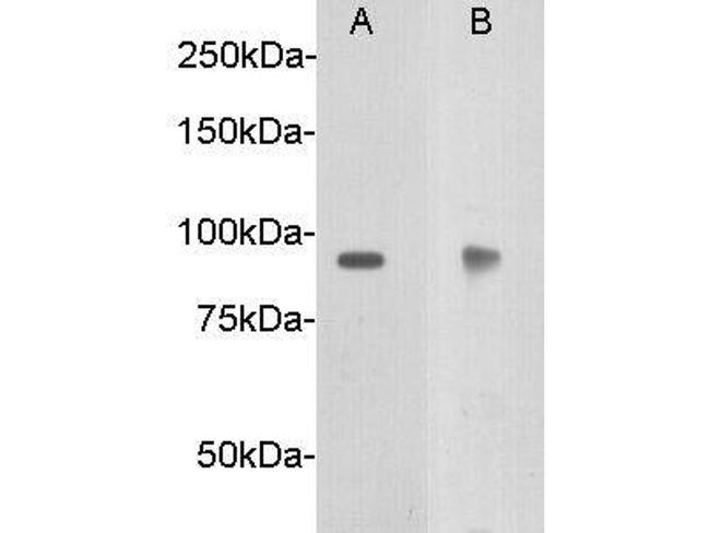 DCC Antibody in Western Blot (WB)