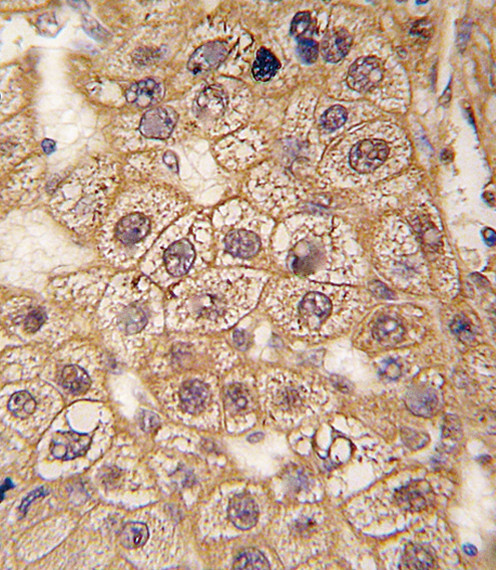 beta-2 Adrenergic Receptor Antibody in Immunohistochemistry (Paraffin) (IHC (P))