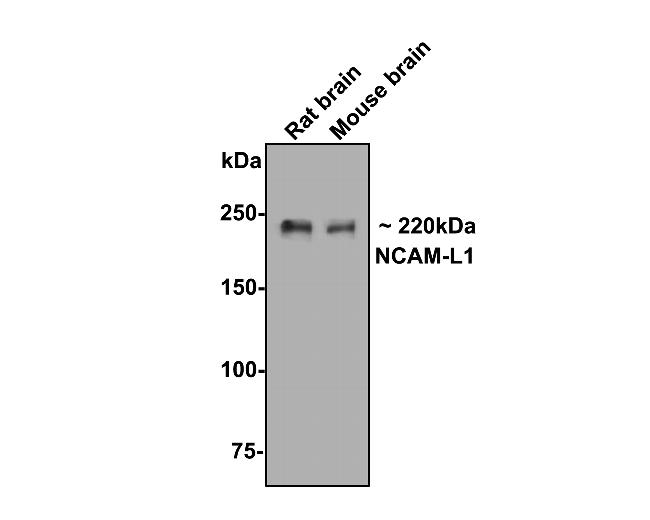 CD171 (L1CAM) Antibody in Immunocytochemistry (ICC/IF)