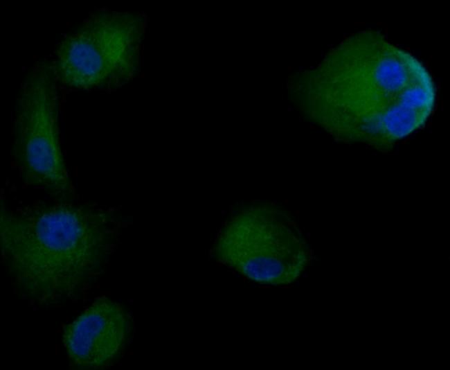 Cytokeratin 18 Antibody in Immunocytochemistry (ICC/IF)