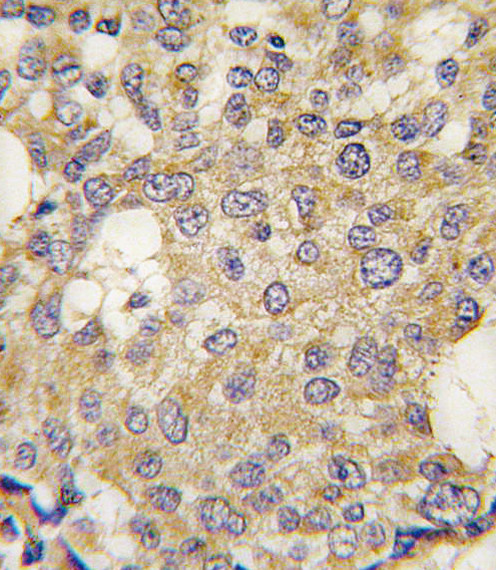 PARG Antibody in Immunohistochemistry (Paraffin) (IHC (P))