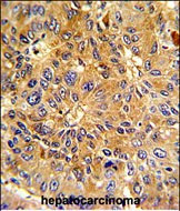 Cyclin A2 Antibody in Immunohistochemistry (Paraffin) (IHC (P))