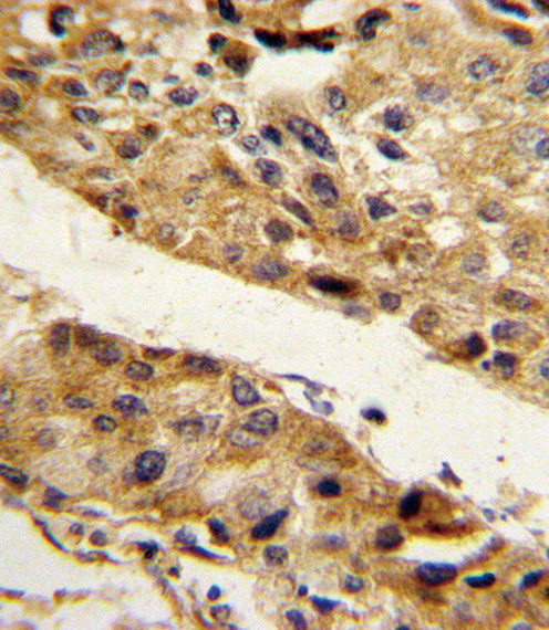 PEDF Antibody in Immunohistochemistry (Paraffin) (IHC (P))