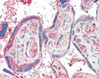 TXK Antibody in Immunohistochemistry (Paraffin) (IHC (P))