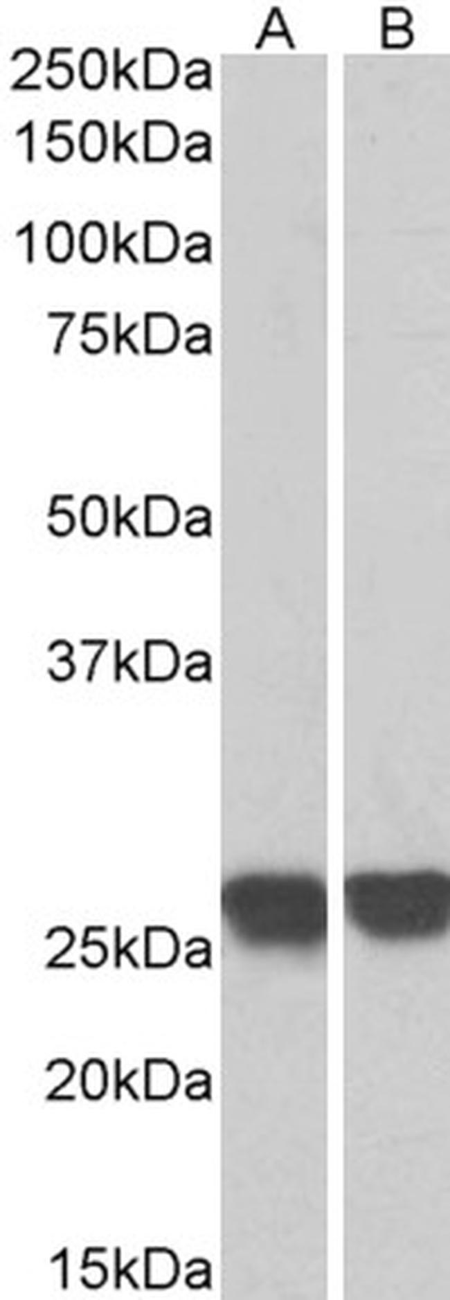 GRB2 Antibody in Western Blot (WB)