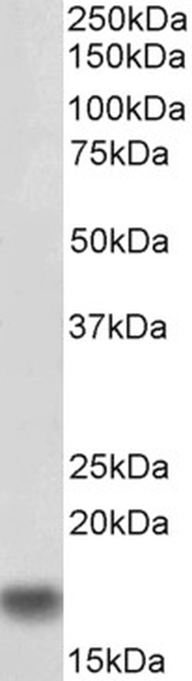 IBA1 Antibody in Western Blot (WB)