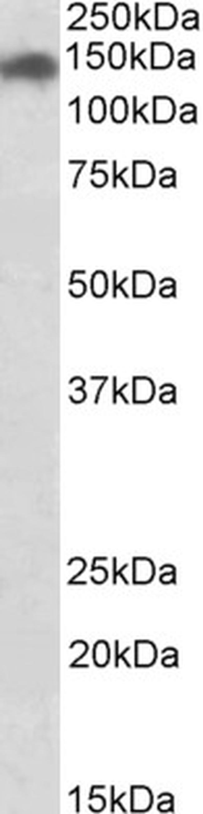 SMC2 Antibody in Western Blot (WB)