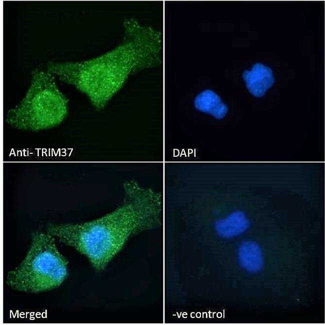 TRIM37 Antibody in Immunocytochemistry (ICC/IF)