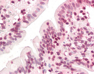 ZIC5 Antibody in Immunohistochemistry (Paraffin) (IHC (P))