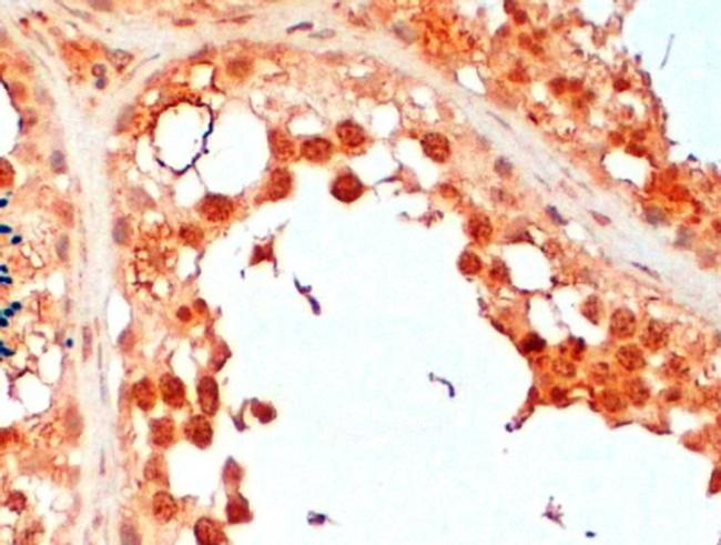 UBC3B Antibody in Immunohistochemistry (Paraffin) (IHC (P))