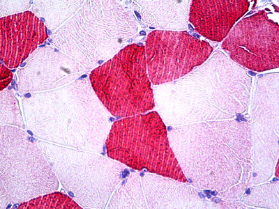 UBE2O Antibody in Immunohistochemistry (Paraffin) (IHC (P))