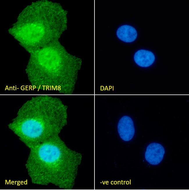 TRIM8 Antibody in Immunocytochemistry (ICC/IF)