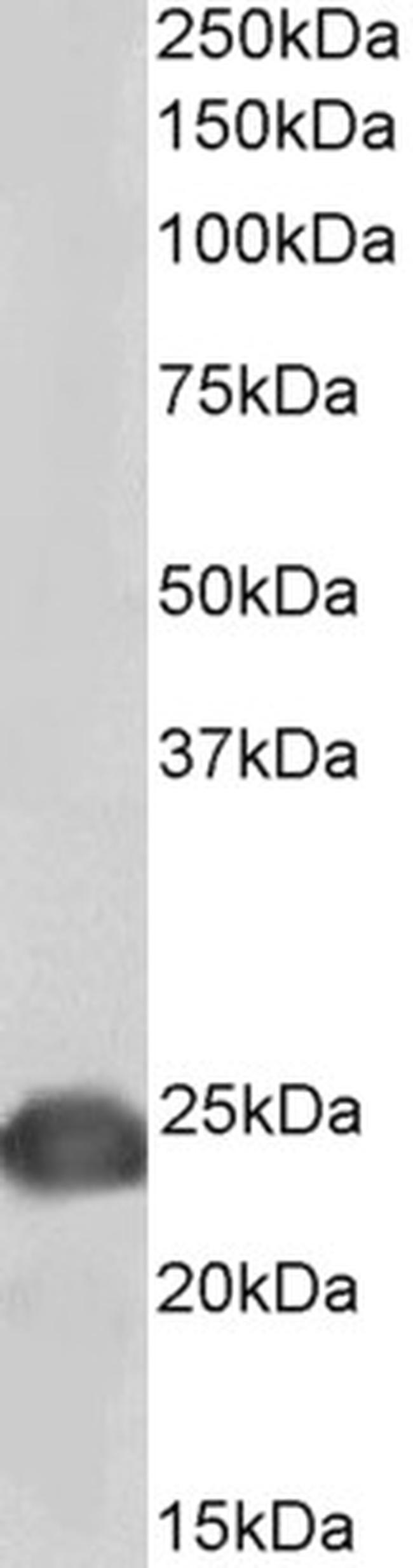 DJ-1 Antibody in Western Blot (WB)