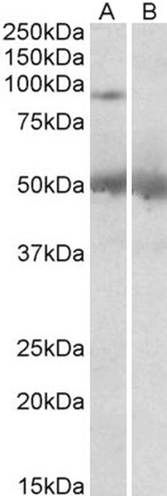 USP6 Antibody in Western Blot (WB)