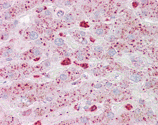 USP15 Antibody in Immunohistochemistry (Paraffin) (IHC (P))