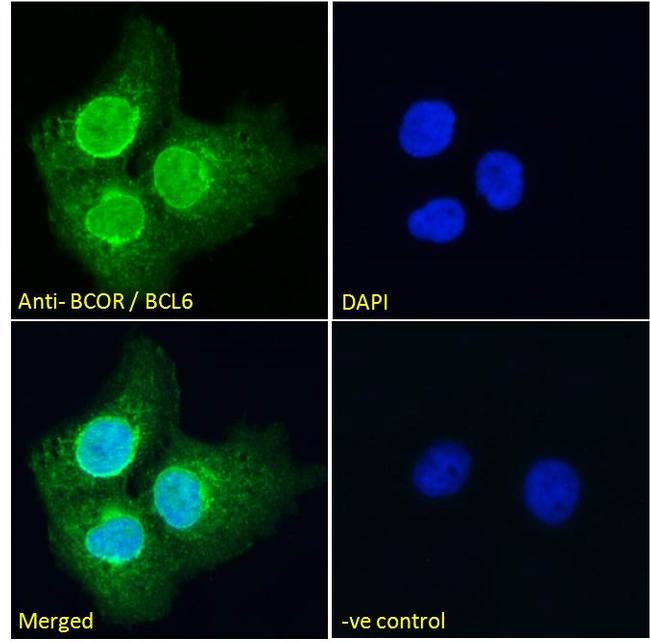 BCOR Antibody in Immunocytochemistry (ICC/IF)