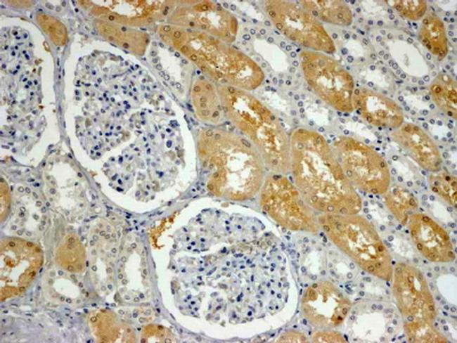 SHROOM2 Antibody in Immunohistochemistry (Paraffin) (IHC (P))