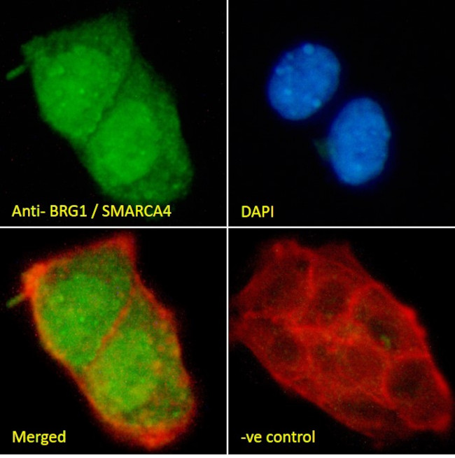 BRG1 Antibody in Immunocytochemistry (ICC/IF)