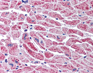 DCLRE1A Antibody in Immunohistochemistry (Paraffin) (IHC (P))