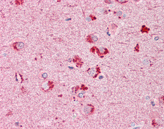 RIF1 Antibody in Immunohistochemistry (Paraffin) (IHC (P))