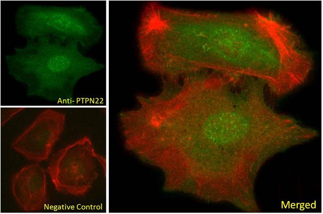 PTPN22 Antibody in Immunocytochemistry (ICC/IF)