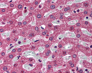 SRD5A1 Antibody in Immunohistochemistry (Paraffin) (IHC (P))