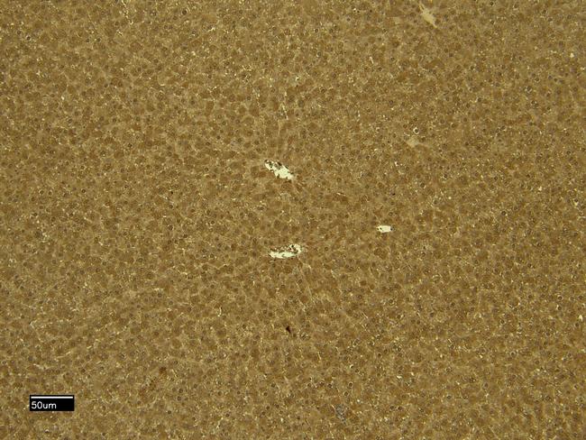 CTGF Antibody in Immunohistochemistry (Paraffin) (IHC (P))