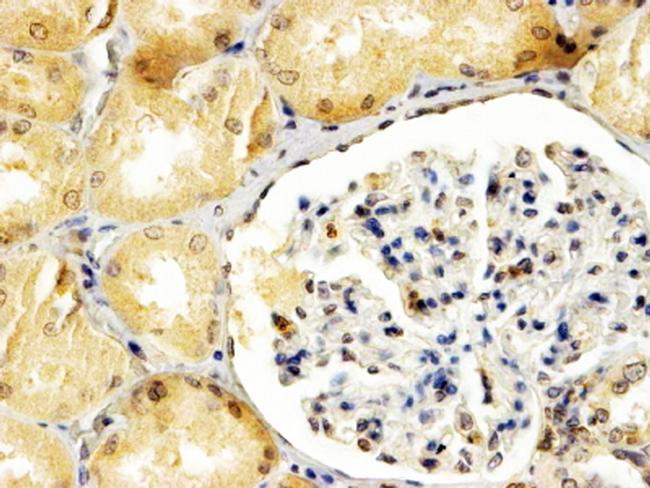 APOBEC3G Antibody in Immunohistochemistry (Paraffin) (IHC (P))