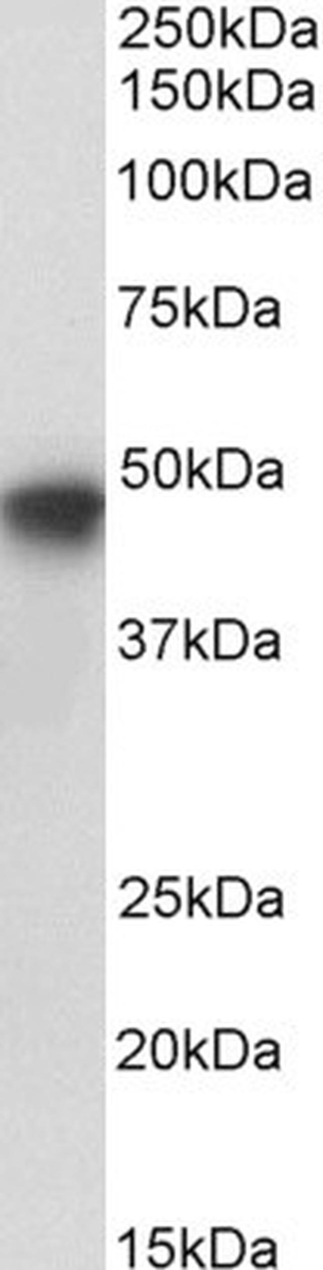 PAI1 Antibody in Western Blot (WB)