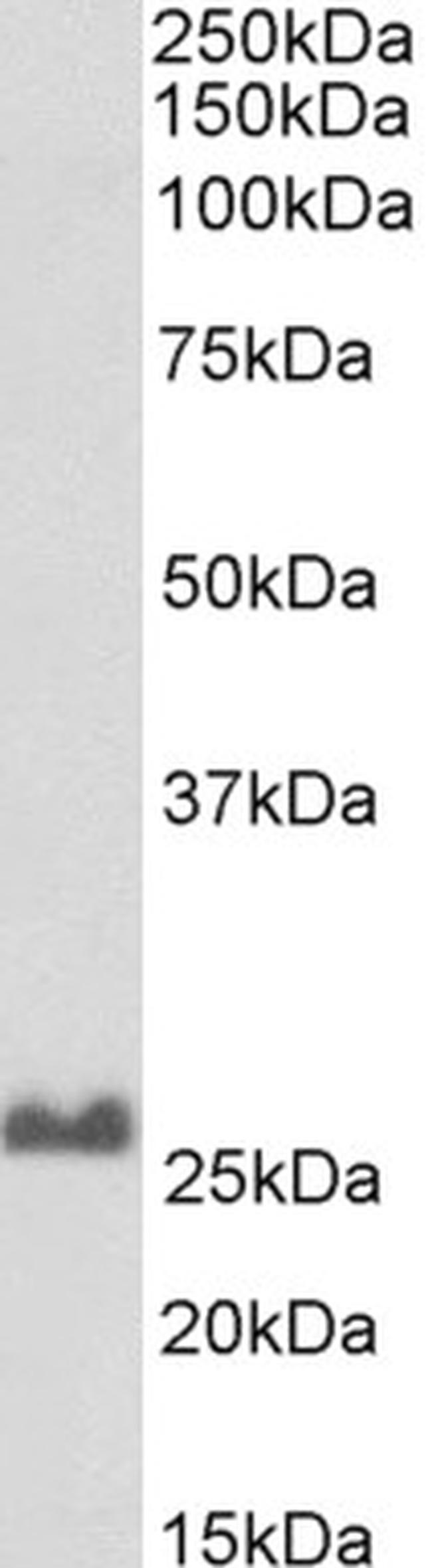 SNAP25 Antibody in Western Blot (WB)