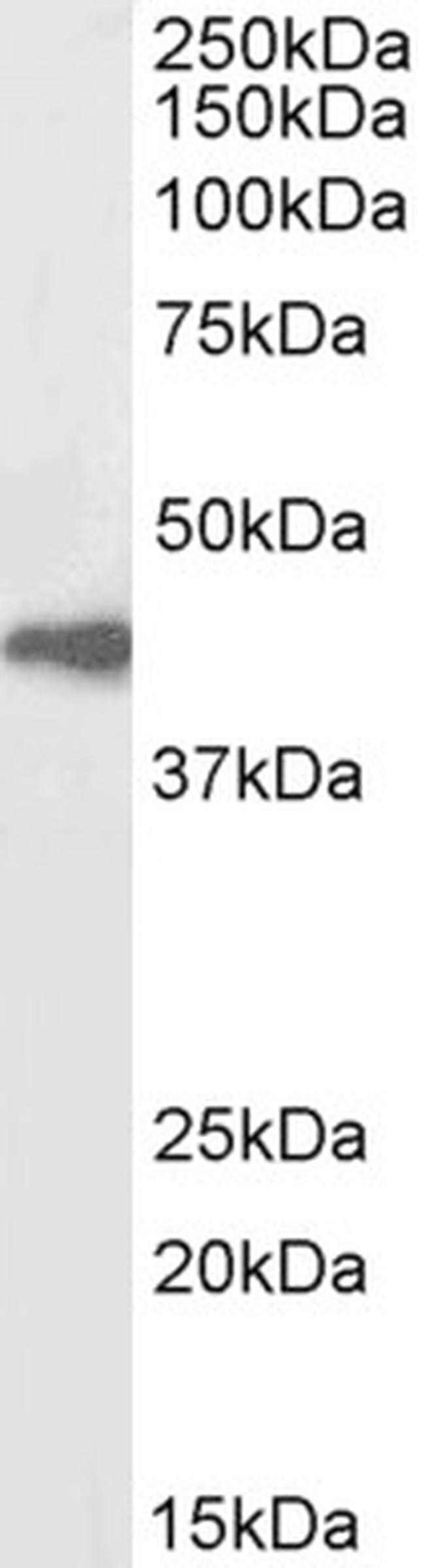 beta-Arrestin 2 Antibody in Western Blot (WB)