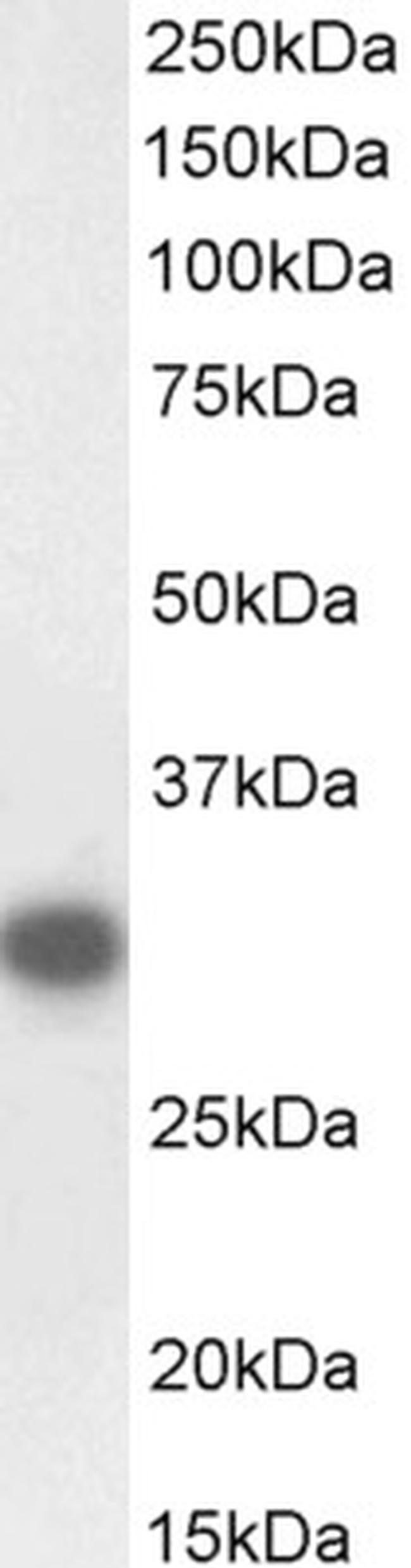 CTDSP1 Antibody in Western Blot (WB)