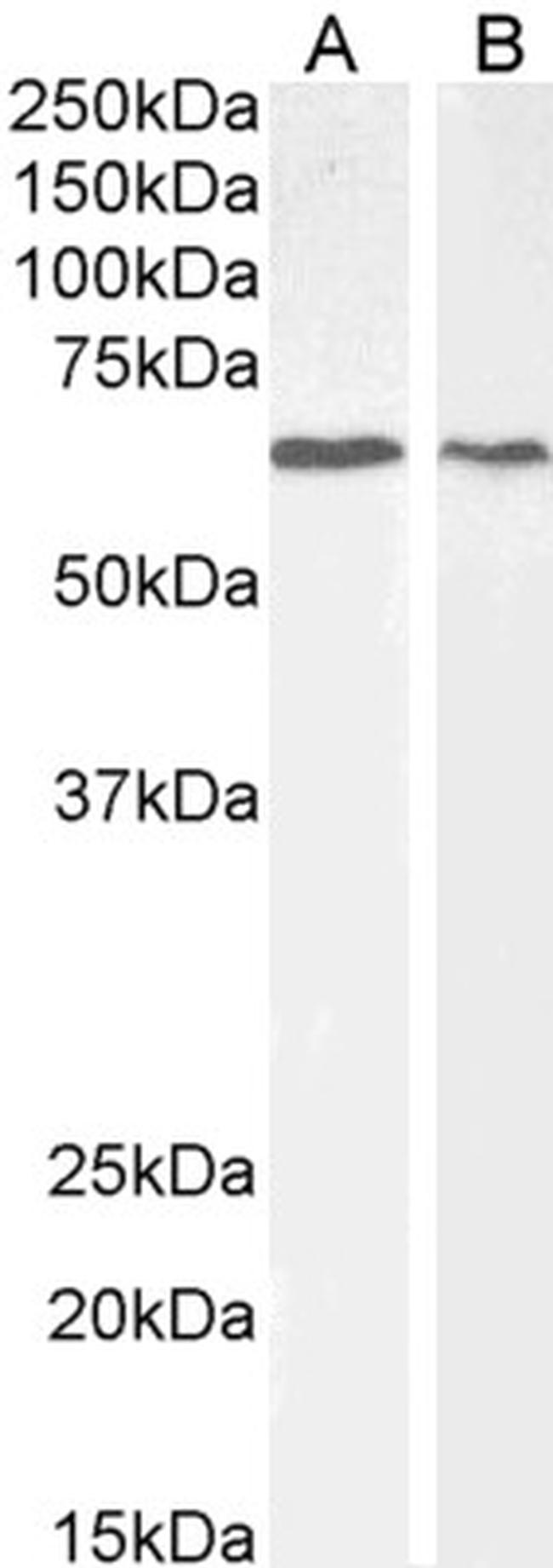 AKT1 Antibody in Western Blot (WB)