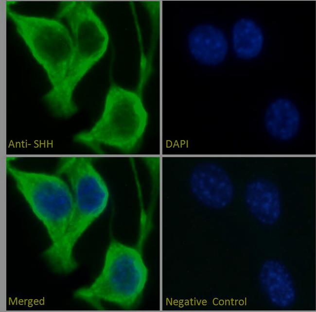 SHH Antibody in Immunocytochemistry (ICC/IF)