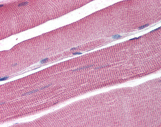 DCLRE1A Antibody in Immunohistochemistry (Paraffin) (IHC (P))