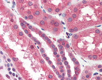 IP3 Receptor 2 Antibody in Immunohistochemistry (Paraffin) (IHC (P))