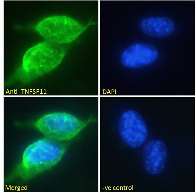 RANKL Antibody in Immunocytochemistry (ICC/IF)