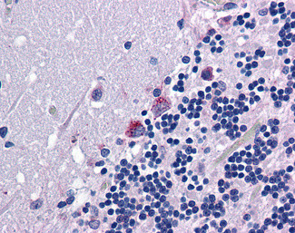 PRODH Antibody in Immunohistochemistry (Paraffin) (IHC (P))