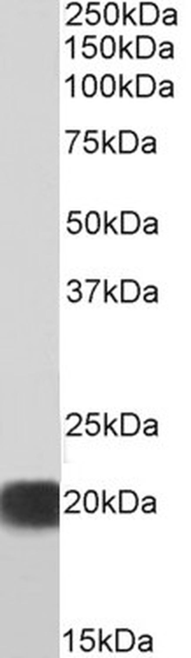 SOD1 Antibody in Western Blot (WB)