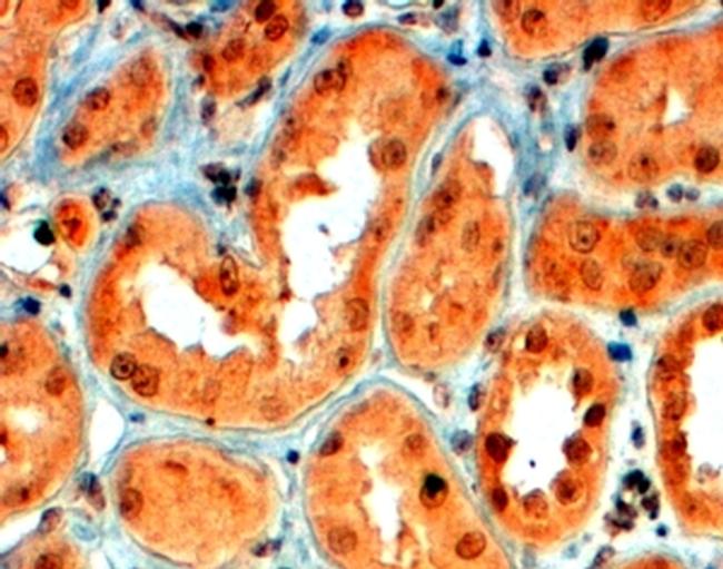 SEMA5A Antibody in Immunohistochemistry (Paraffin) (IHC (P))