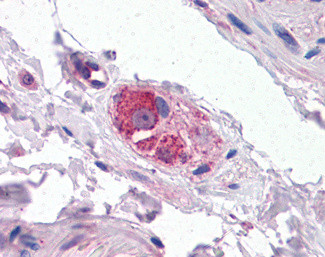 CYP26B1 Antibody in Immunohistochemistry (Paraffin) (IHC (P))