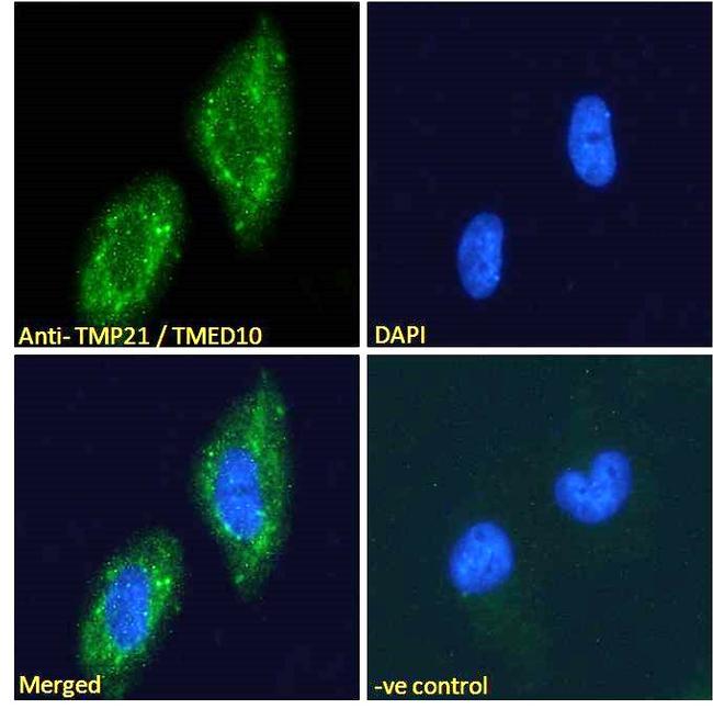 TMP21 Antibody in Immunocytochemistry (ICC/IF)