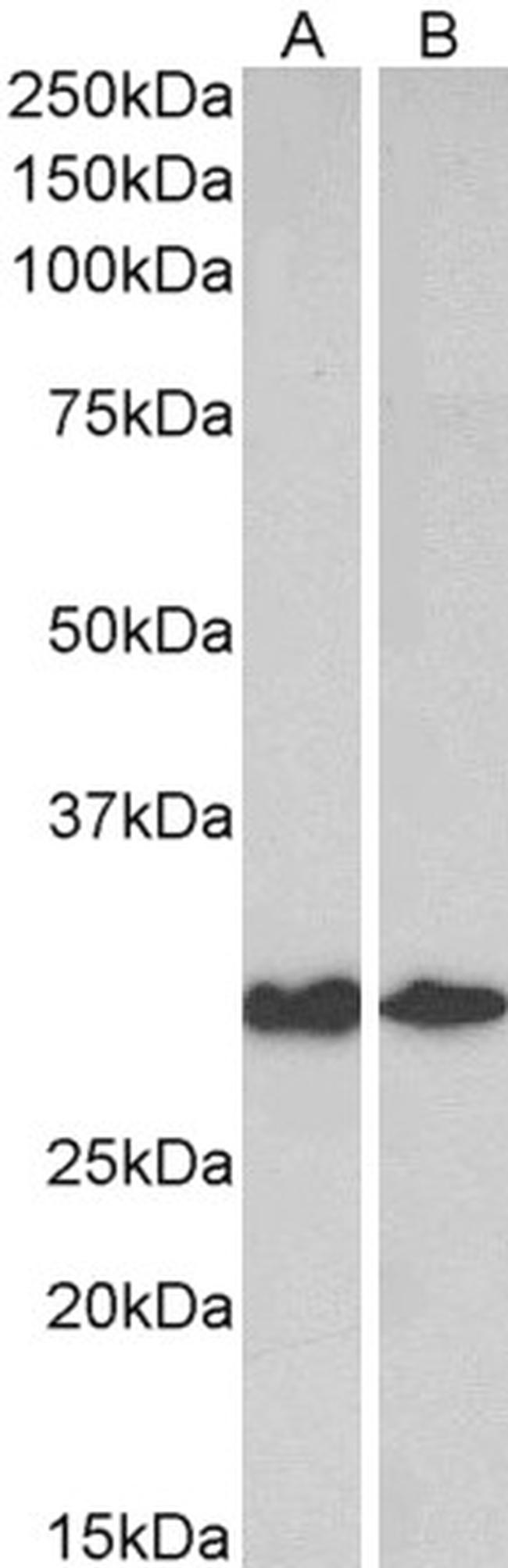 Galectin 3 Antibody in Western Blot (WB)