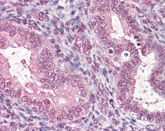 CTDSP1 Antibody in Immunohistochemistry (Paraffin) (IHC (P))